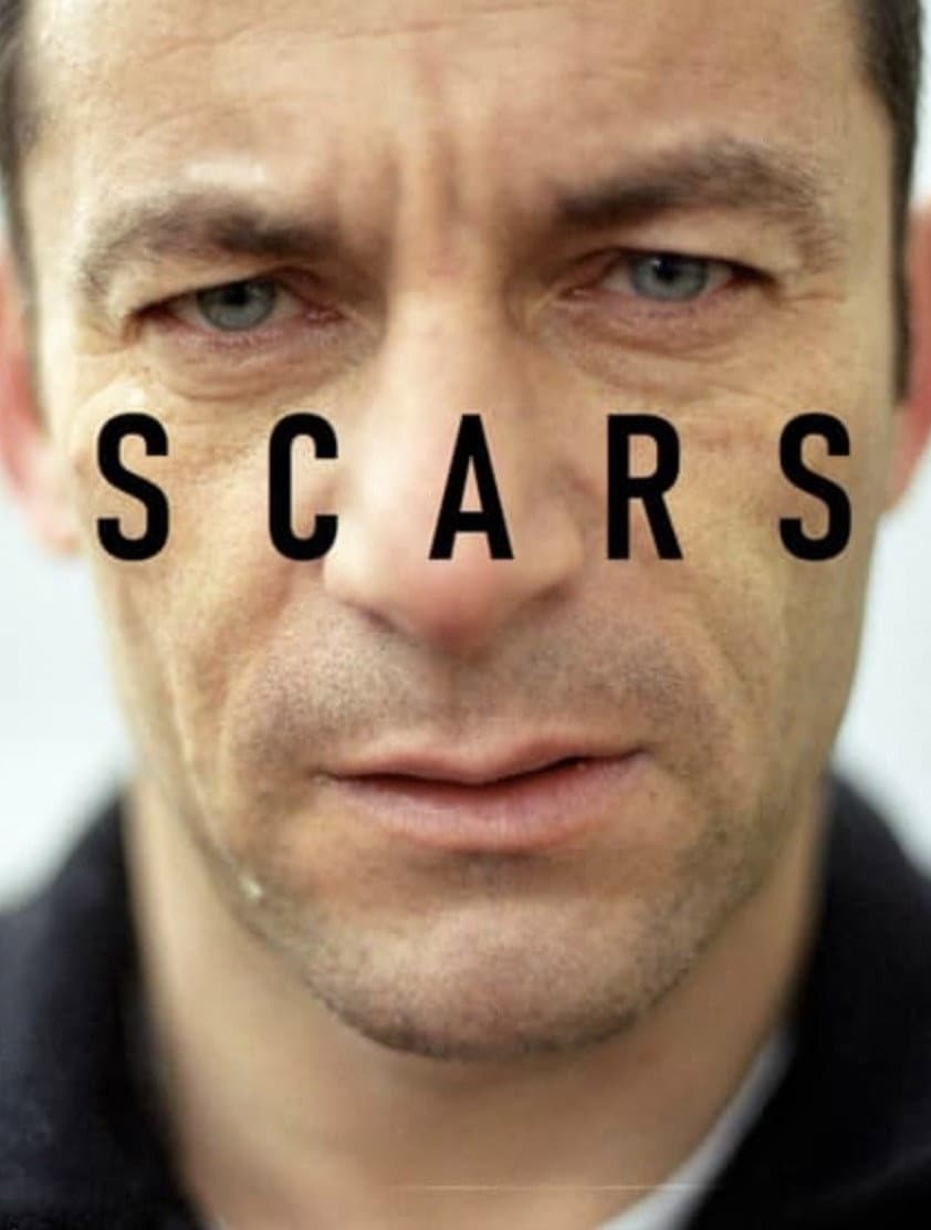 Scars backdrop