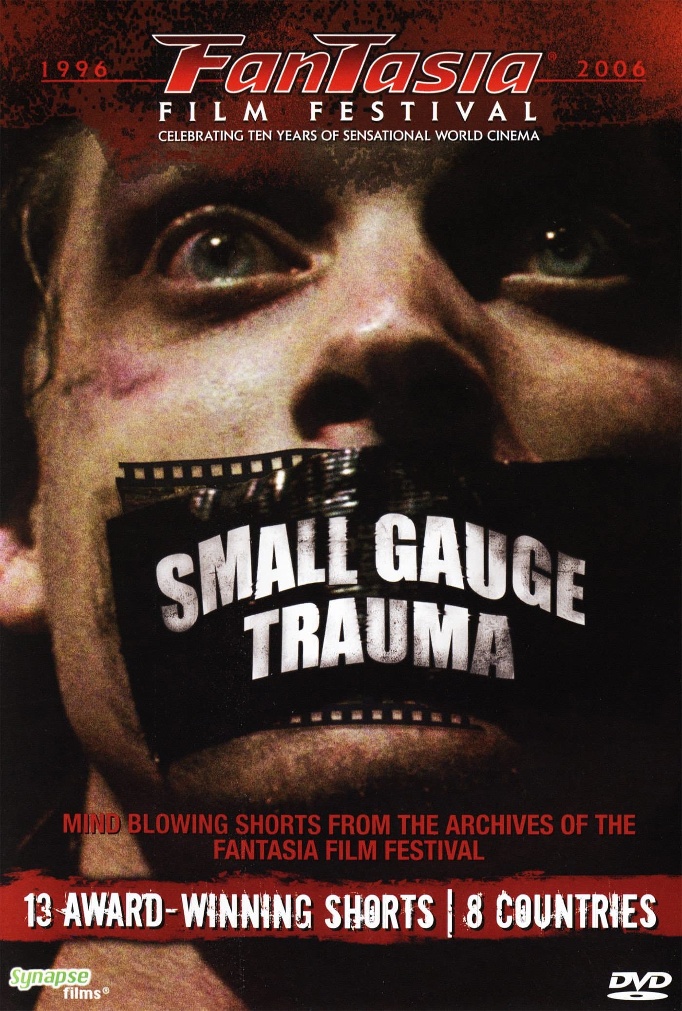 Small Gauge Trauma backdrop