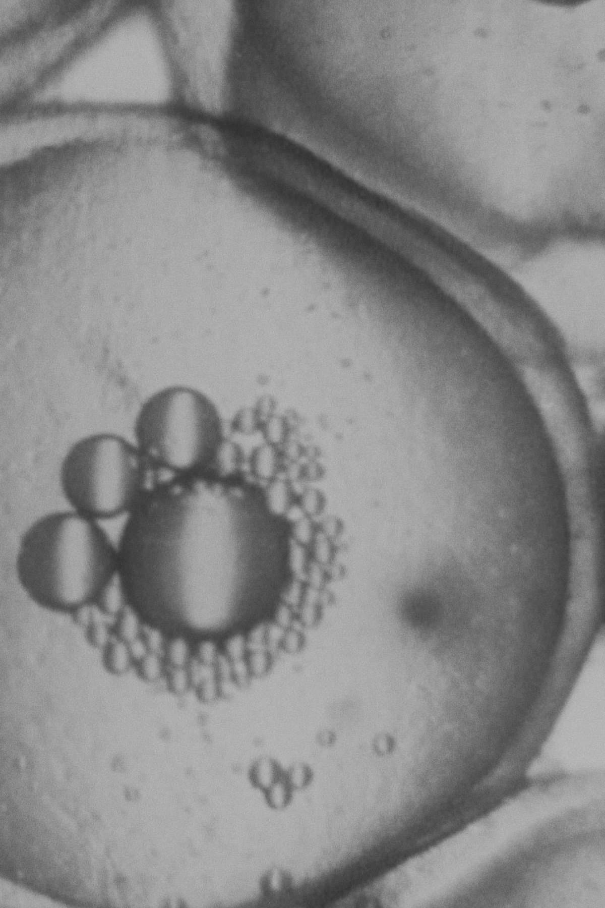 The Stickleback's Eggs backdrop