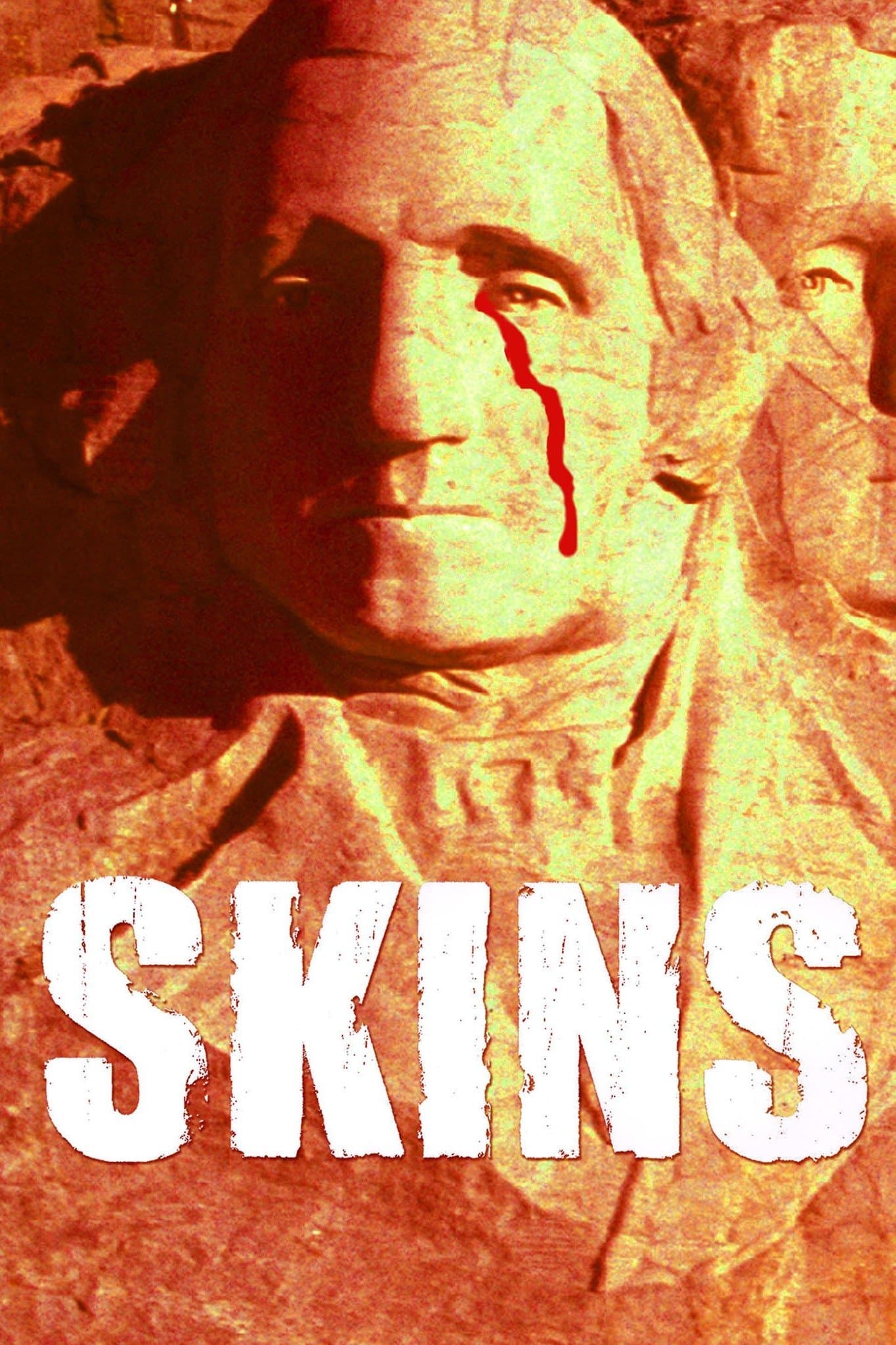 Skins backdrop